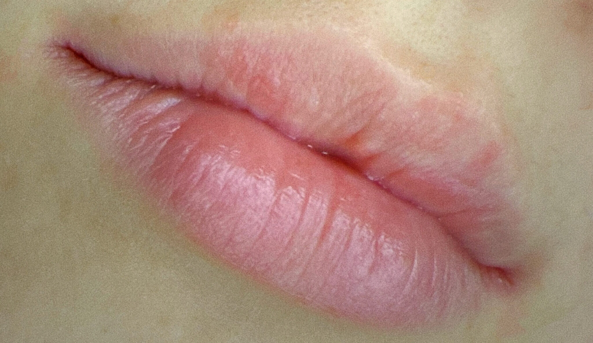 IMG_2468 {"ARInfo":{"IsUseAR":false},"Version":"1.0.0","MakeupInfo":{"IsUseMakeup":false},"FaceliftInfo":{"IsChangeEyeLift":false,"IsChangeFacelift":false,"IsChangePostureLift":false,"IsChangeNose":false,"IsChangeFaceChin":false,"IsChangeMouth":false,"IsChangeThinFace":false},"BeautyInfo":{"SwitchMedicatedAcne":false,"IsAIBeauty":false,"IsBrightEyes":false,"IsSharpen":false,"IsOldBeauty":false,"IsReduceBlackEyes":false},"HandlerInfo":{"AppName":2},"FilterInfo":{"IsUseFilter":false}}