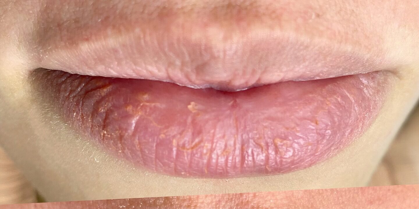 rosenunesbeauty_472335390_18352595365127406_1896015641401334358_n rosenunesbeauty_472335390_18352595365127406_1896015641401334358_n